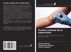 Buchcover von Prueba cutánea de la tuberculina