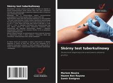 Copertina di Skórny test tuberkulinowy