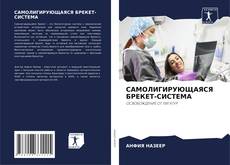 Copertina di САМОЛИГИРУЮЩАЯСЯ БРЕКЕТ-СИСТЕМА