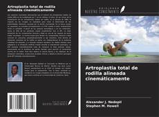 Buchcover von Artroplastia total de rodilla alineada cinemáticamente