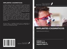 Capa do livro de IMPLANTES CIGOMÁTICOS 