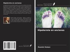 Buchcover von Hipotermia en ancianos