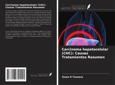 Couverture de Carcinoma hepatocelular (CHC): Causas Tratamientos Resumen