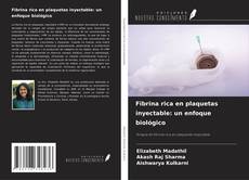 Обложка Fibrina rica en plaquetas inyectable: un enfoque biológico