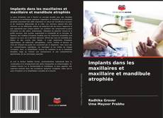 Обложка Implants dans les maxillaires et maxillaire et mandibule atrophiés