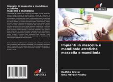 Обложка Impianti in mascelle e mandibole atrofiche mascella e mandibola