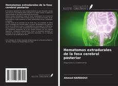 Copertina di Hematomas extradurales de la fosa cerebral posterior