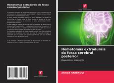 Copertina di Hematomas extradurais da fossa cerebral posterior