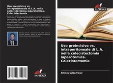 Bookcover of Uso preincisivo vs. intraperitoneale di L.A. nella colecistectomia laparotomica. Colecistectomia