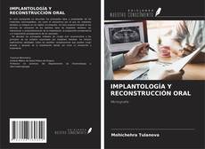 Couverture de IMPLANTOLOGÍA Y RECONSTRUCCIÓN ORAL