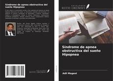 Couverture de Síndrome de apnea obstructiva del sueño Hipopnea