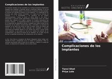 Buchcover von Complicaciones de los implantes