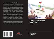 Buchcover von Complications des implants