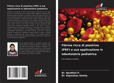 Обложка Fibrina ricca di piastrine (PRF) e sua applicazione in odontoiatria pediatrica