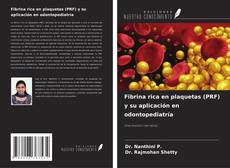 Buchcover von Fibrina rica en plaquetas (PRF) y su aplicación en odontopediatría