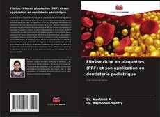 Buchcover von Fibrine riche en plaquettes (PRF) et son application en dentisterie pédiatrique
