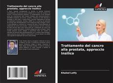 Borítókép a  Trattamento del cancro alla prostata, approccio Insilico - hoz