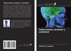 Copertina di Tuberculosis cerebral y vertebral