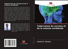 Buchcover von Tuberculose du cerveau et de la colonne vertébrale