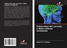 Borítókép a  Tubercolosi del cervello e della colonna vertebrale - hoz
