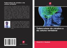 Copertina di Tuberculose do cérebro e da coluna vertebral