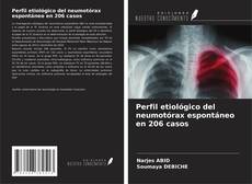 Copertina di Perfil etiológico del neumotórax espontáneo en 206 casos