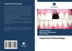 Implantat-Fehlschläge kitap kapağı