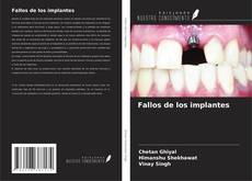 Fallos de los implantes kitap kapağı