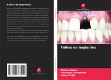 Copertina di Falhas de implantes