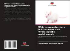 Copertina di Effets neuroprotecteurs de l'Edaravone dans l'hydrocéphalie expérimentale