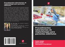 Copertina di Procedimentos laboratoriais de implantologia para pacientes edêntulos