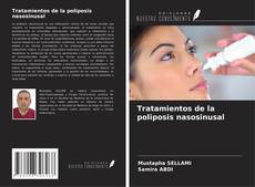 Buchcover von Tratamientos de la poliposis nasosinusal
