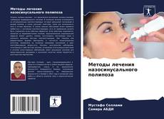 Bookcover of Методы лечения назосинусального полипоза