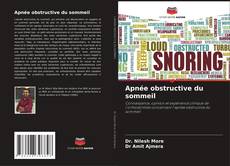 Copertina di Apnée obstructive du sommeil