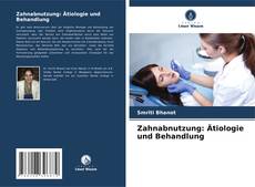 Copertina di Zahnabnutzung: Ätiologie und Behandlung