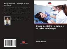 Copertina di Usure dentaire : étiologie et prise en charge