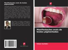 Bookcover of Manifestações orais de lesões pigmentadas