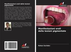 Обложка Manifestazioni orali delle lesioni pigmentate