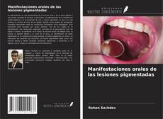 Buchcover von Manifestaciones orales de las lesiones pigmentadas