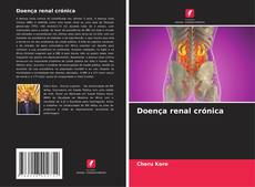 Bookcover of Doença renal crónica