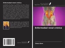 Buchcover von Enfermedad renal crónica