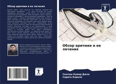Capa do livro de Обзор аритмии и ее лечения 