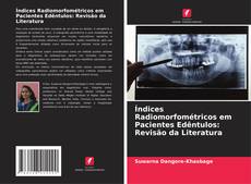 Bookcover of Índices Radiomorfométricos em Pacientes Edêntulos: Revisão da Literatura