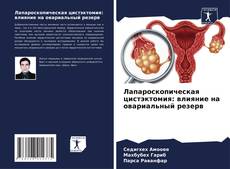 Couverture de Лапароскопическая цистэктомия: влияние на овариальный резерв