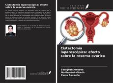 Buchcover von Cistectomía laparoscópica: efecto sobre la reserva ovárica