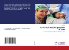 Buchcover von Caesarean section protocol of care