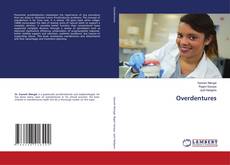 Capa do livro de Overdentures 