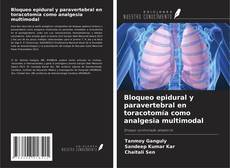 Bloqueo epidural y paravertebral en toracotomía como analgesia multimodal的封面