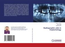 Borítókép a  Radiographic aids in Implantology - hoz