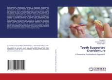 Bookcover of Tooth Supported Overdenture